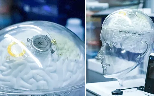 Sôi động cuộc đua công nghệ não bộ Sôi động cuộc đua công nghệ não bộ