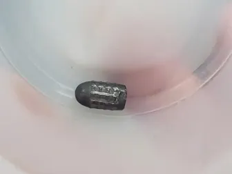 Làm rõ vụ người phụ nữ bị trúng đạn vào đầu khi đang làm vườn