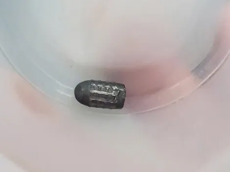 Làm rõ vụ người phụ nữ bị trúng đạn vào đầu khi đang làm vườn