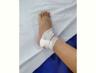 Cảnh báo nguy cơ rắn cắn trẻ nhỏ trong mùa nước nổi