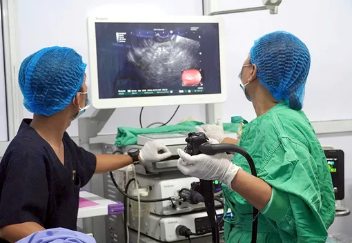 Lần đầu tiên tại ĐBSCL điều trị thành công bệnh nang giả tụy bằng kỹ thuật đặt stent LAMS dưới hướng dẫn của máy nội soi siêu âm