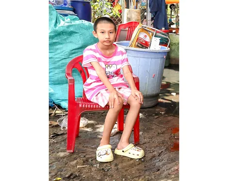 Bé gái 9 tuổi mắc u não ác tính cần được giúp đỡ