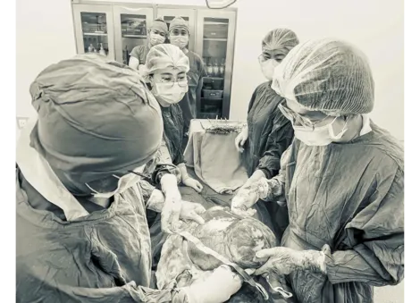 Bác sĩ sản khoa Cần Thơ mổ thành công 2 ca u xơ tử cung lấn hết ổ bụng