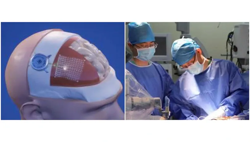 Trung Quốc thúc đẩy công nghệ chiến lược mới: chip não