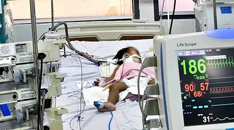 Cứu sống bé gái 20 tháng tuổi bị bệnh tay chân miệng độ 4 nguy kịch