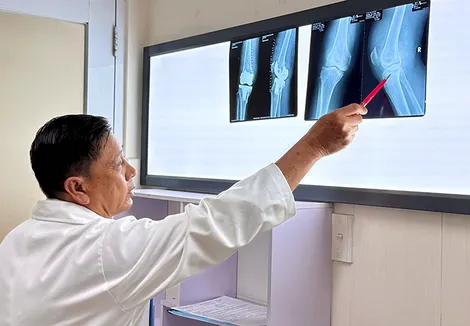 Phẫu thuật thay khớp gối, phục hồi vận động cho nữ bệnh nhân đau khớp kéo dài