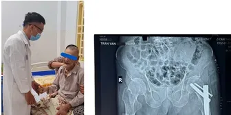 Ngừa nguy cơ té ngã ở người cao tuổi