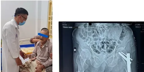 Ngừa nguy cơ té ngã ở người cao tuổi