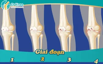 Nguyên tắc điều trị