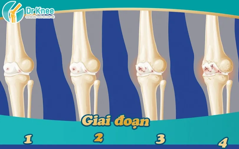 Nguyên tắc điều trị