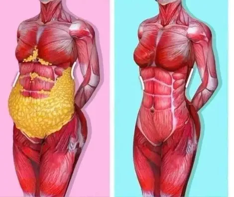 Mỡ nội tạng làm tăng nguy cơ suy giảm trí nhớ