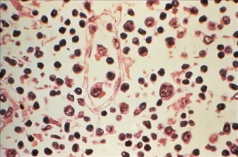 Argentina ghi nhận ca bệnh mắc virus Hanta tăng mạnh