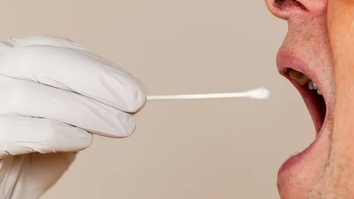 Phát hiện mối liên hệ giữa viêm nha chu và vô sinh nữ