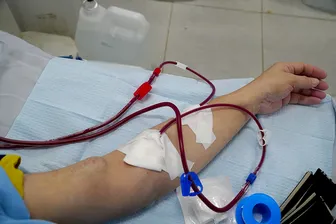 Ngứa âm ỉ: Triệu chứng cảnh báo bệnh suy thận