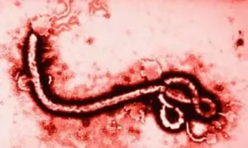 Không nên hoang mang trước những thông tin chưa kiểm chứng về virus Ebola