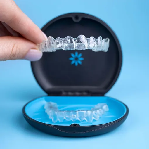 Niềng Invisalign bị lỏng khay có sao không? Khi nào cần đổi khay hoặc đi khám?